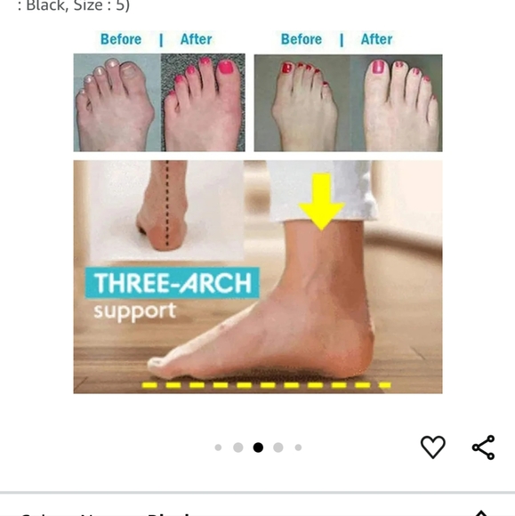 Sandal Foot Correction - Picture 2 of 4